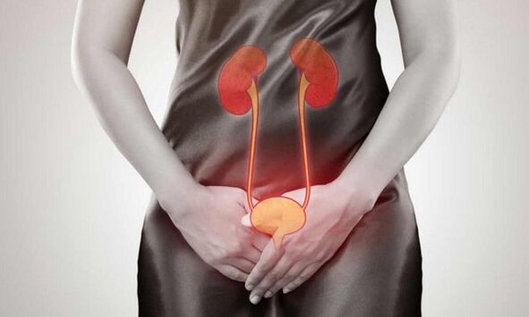 Oorzaken en behandeling van cystitis bij vrouwen