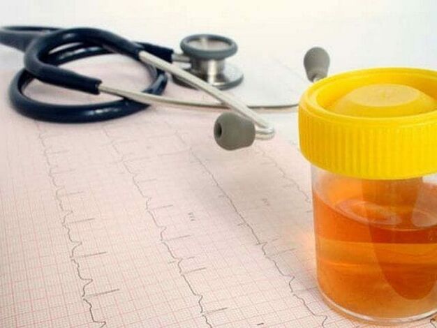 urineanalyse om blaasontsteking te diagnosticeren