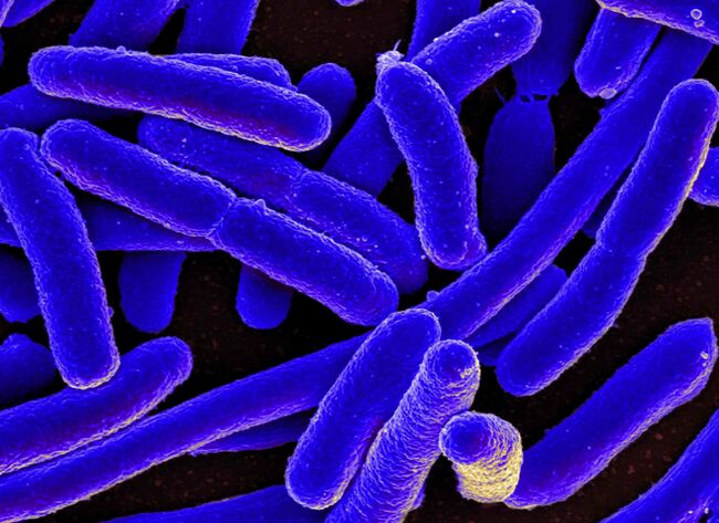 E. coli veroorzaakt meestal de ontwikkeling van blaasontsteking bij vrouwen